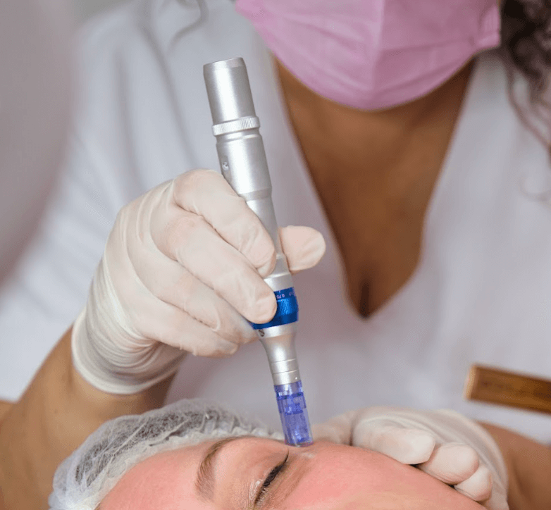 Dermapen Facial